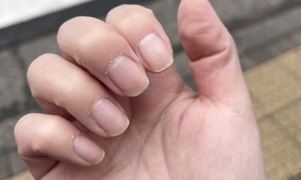 ネイルケア後にささくれができる原因はメタルプッシャー？-ネイルサロン開業・経営コンサルティング東京で開催