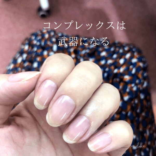 サロン開業ではコンプレックスは武器になる｜ネイルサロン開業・経営ならビオネイル